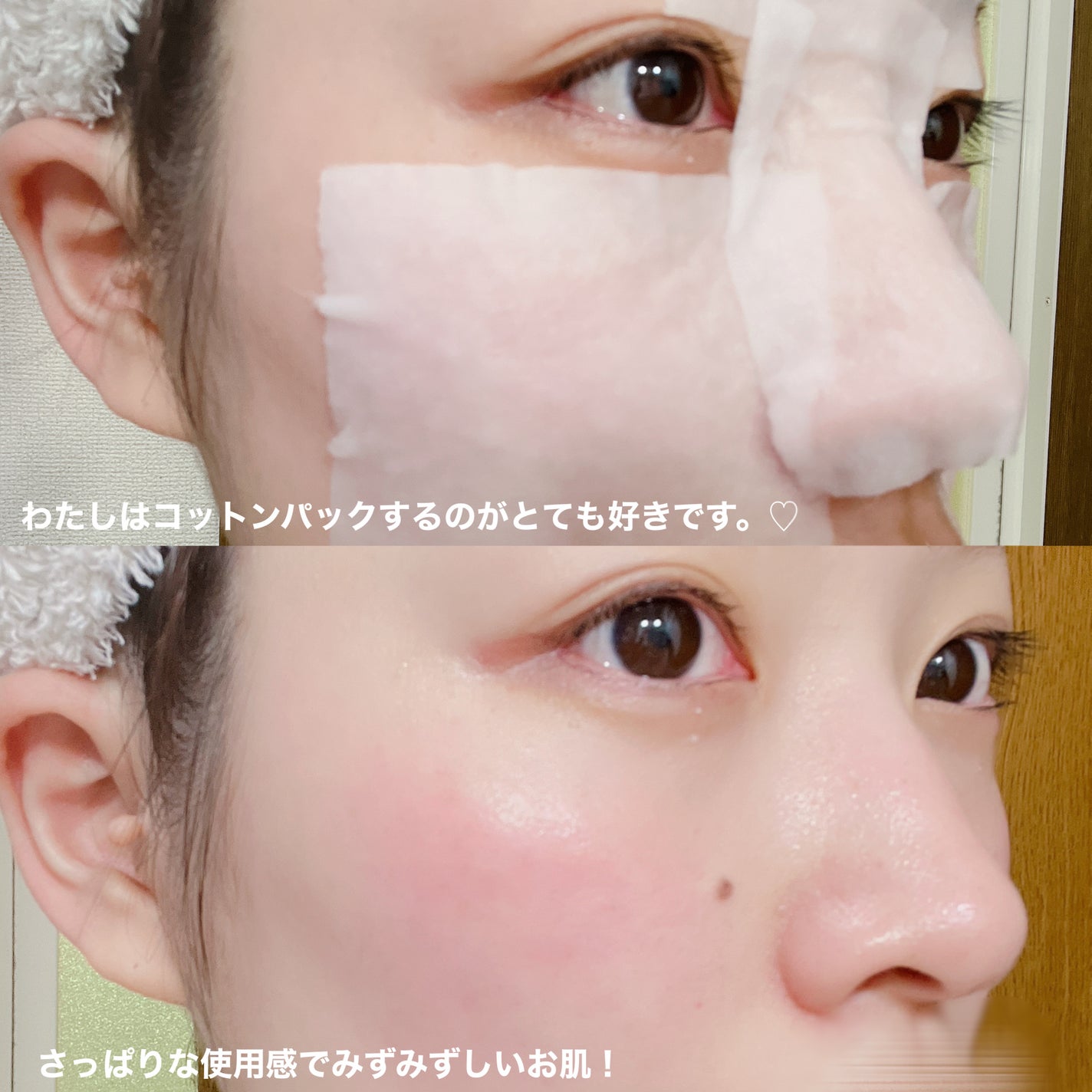 ドクダミ 77 スージングトナー/Anua/化粧水を使ったクチコミ(3枚目)