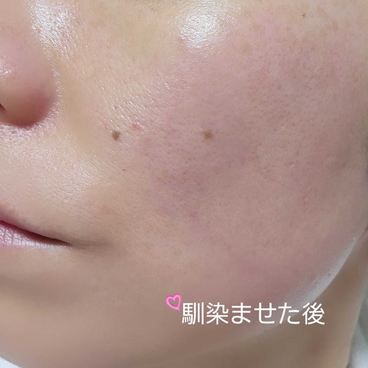 EXO THE LAB.SERUM/EXO THE LAB./美容液を使ったクチコミ(4枚目)