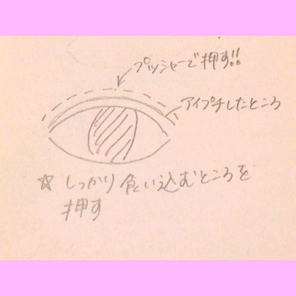 アイトーク/アイトーク/二重まぶた用アイテムを使ったクチコミ（3枚目）