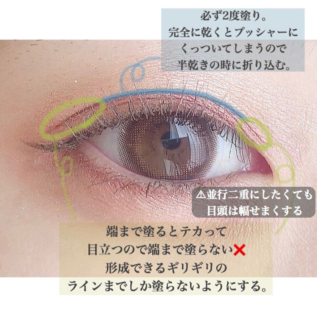 みっくす on LIPS 「*前回二重事情の投稿をしたときにかなりのいいねとクリップを頂い..」(4枚目)