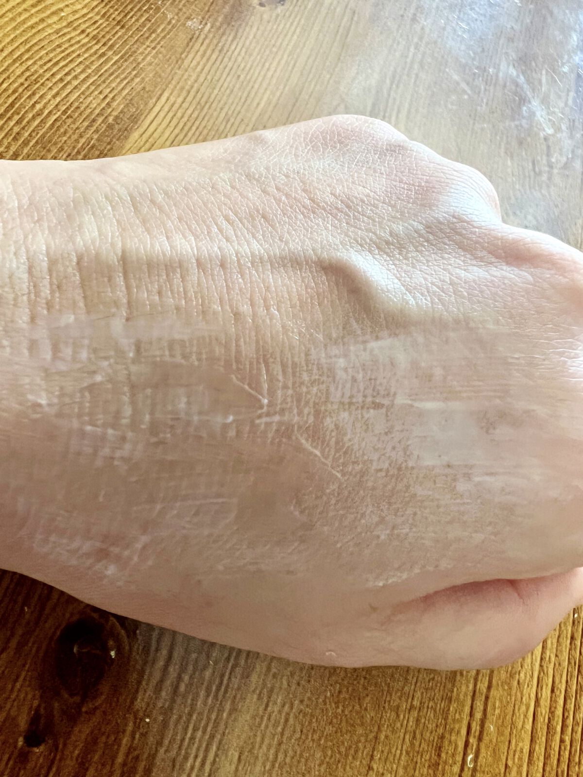 ザーネクリーム/ザーネ/ボディクリームを使ったクチコミ（3枚目）