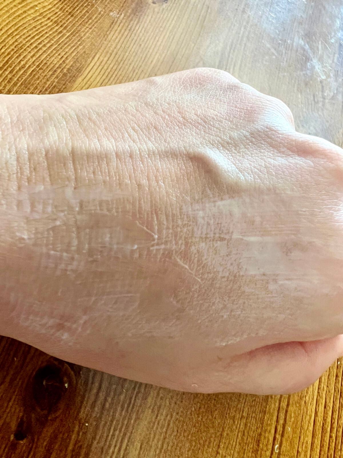 ザーネクリーム/ザーネ/ボディクリームを使ったクチコミ(3枚目)