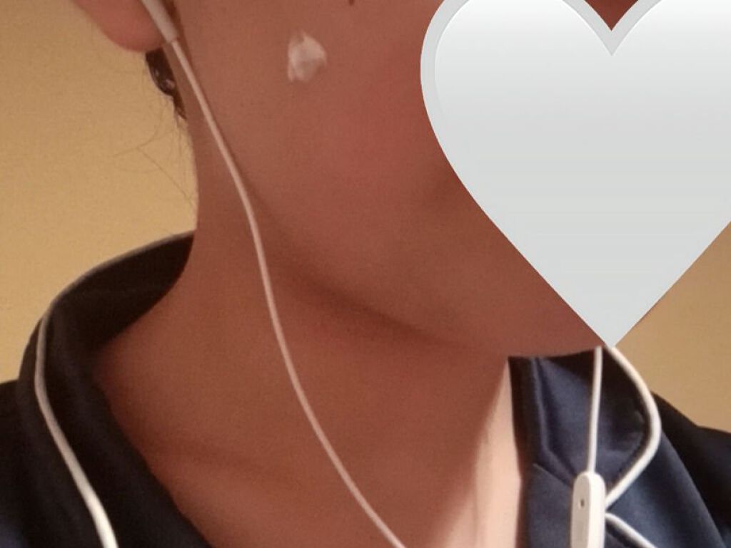 ペアアクネクリームW(医薬品)/ペア/その他を使ったクチコミ（1枚目）