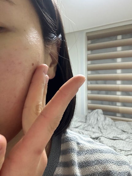 ステムⅢアンプル/IOPE/美容液を使ったクチコミ(3枚目)