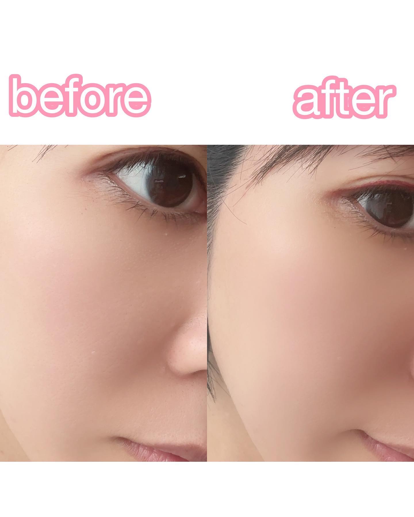 シカレチA エッセンス0.1/VT/美容液を使ったクチコミ（2枚目）