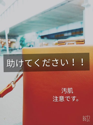 こんにちは。こんばんは。
あめすぴ。さんです。

助けてください！！
ニキビ、ニキビ跡が最近本当にすごく、赤みやボツボツが増えて学校やバイト先でマスクをはずす事ができません！(2枚目以降無加工)
ニキビ