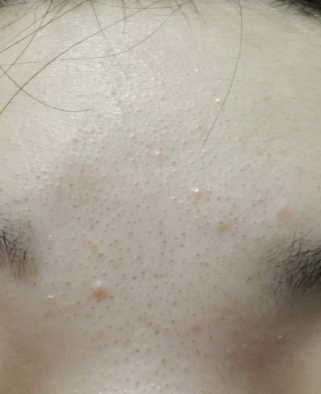 ハトムギ化粧水(ナチュリエ スキンコンディショナー R )/ナチュリエ/化粧水を使ったクチコミ（2枚目）