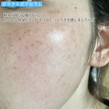 サミュ ガラクトポア セラム/SAM'U/美容液を使ったクチコミ(9枚目)