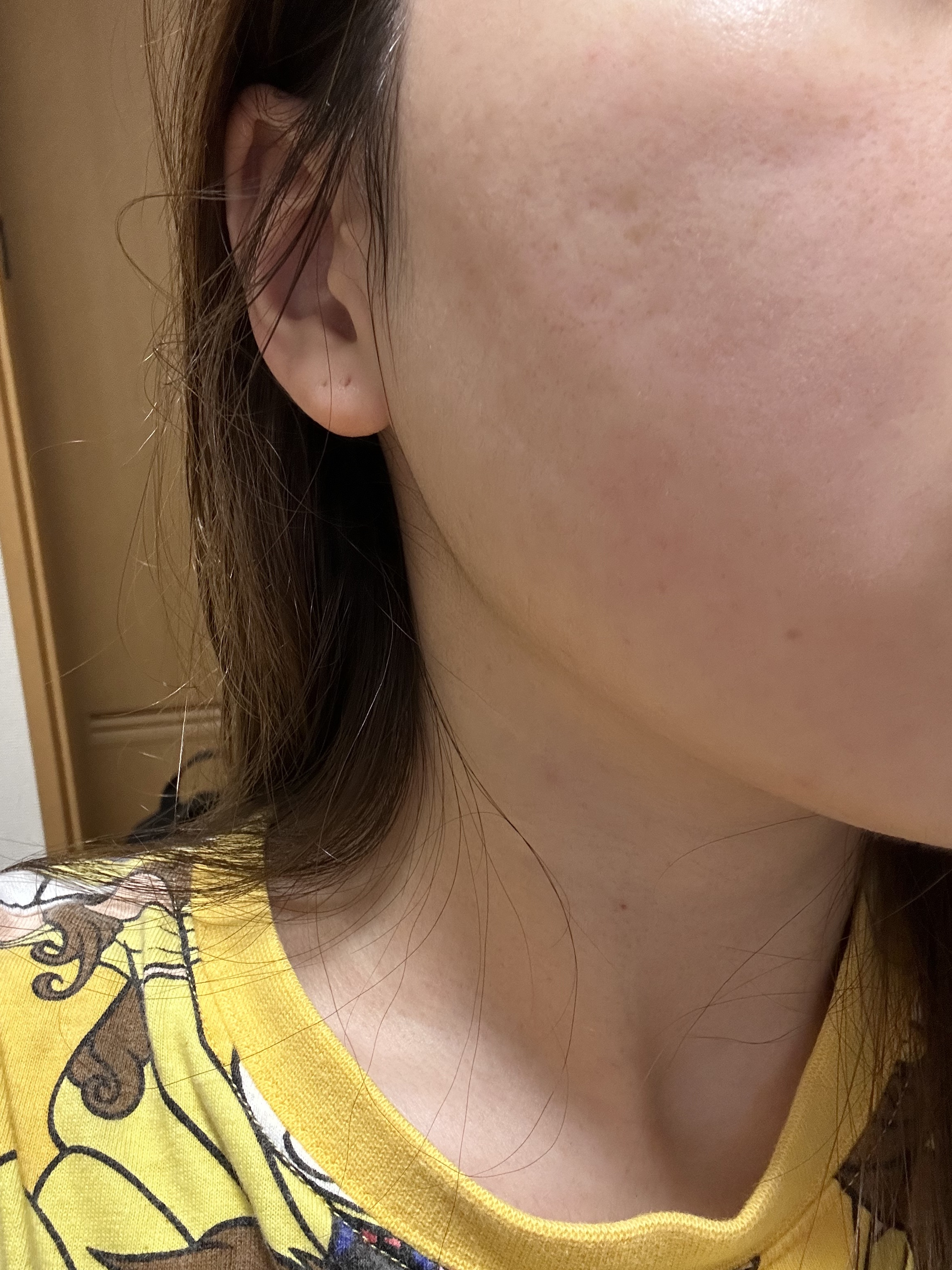 どんぐり ポア ペプチド パッド/SKINFOOD/トナーパッドを使ったクチコミ（2枚目）