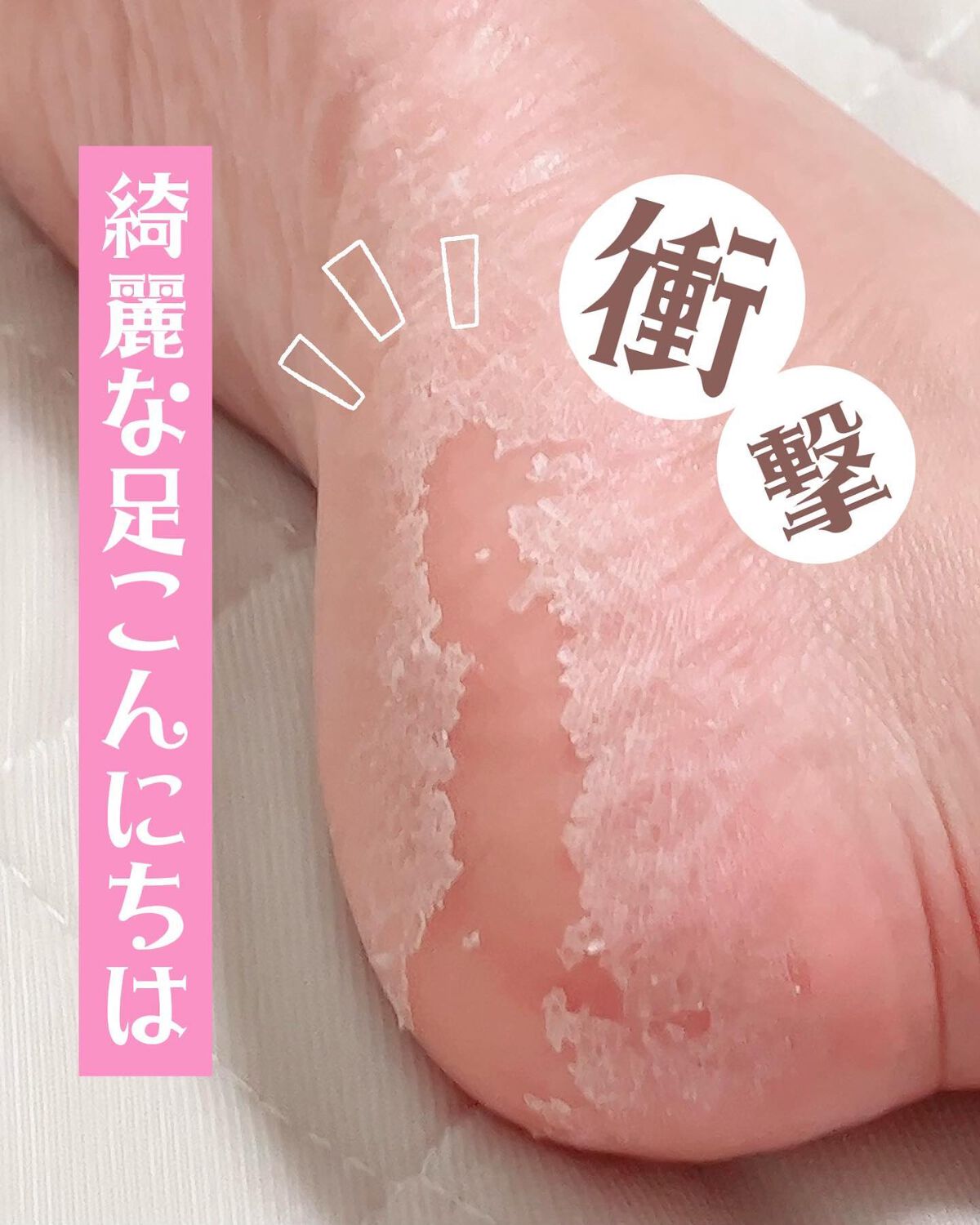 イージーパックSPT 30分タイプ/ベビーフット/レッグ・フットケアを使ったクチコミ(1枚目)