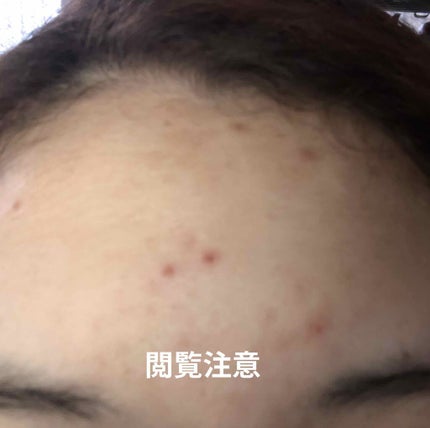 ホホバオイル/無印良品/ボディオイルを使ったクチコミ(1枚目)