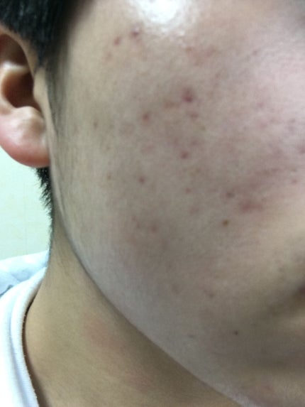 化粧水・敏感肌用・高保湿タイプ/無印良品/化粧水を使ったクチコミ(2枚目)