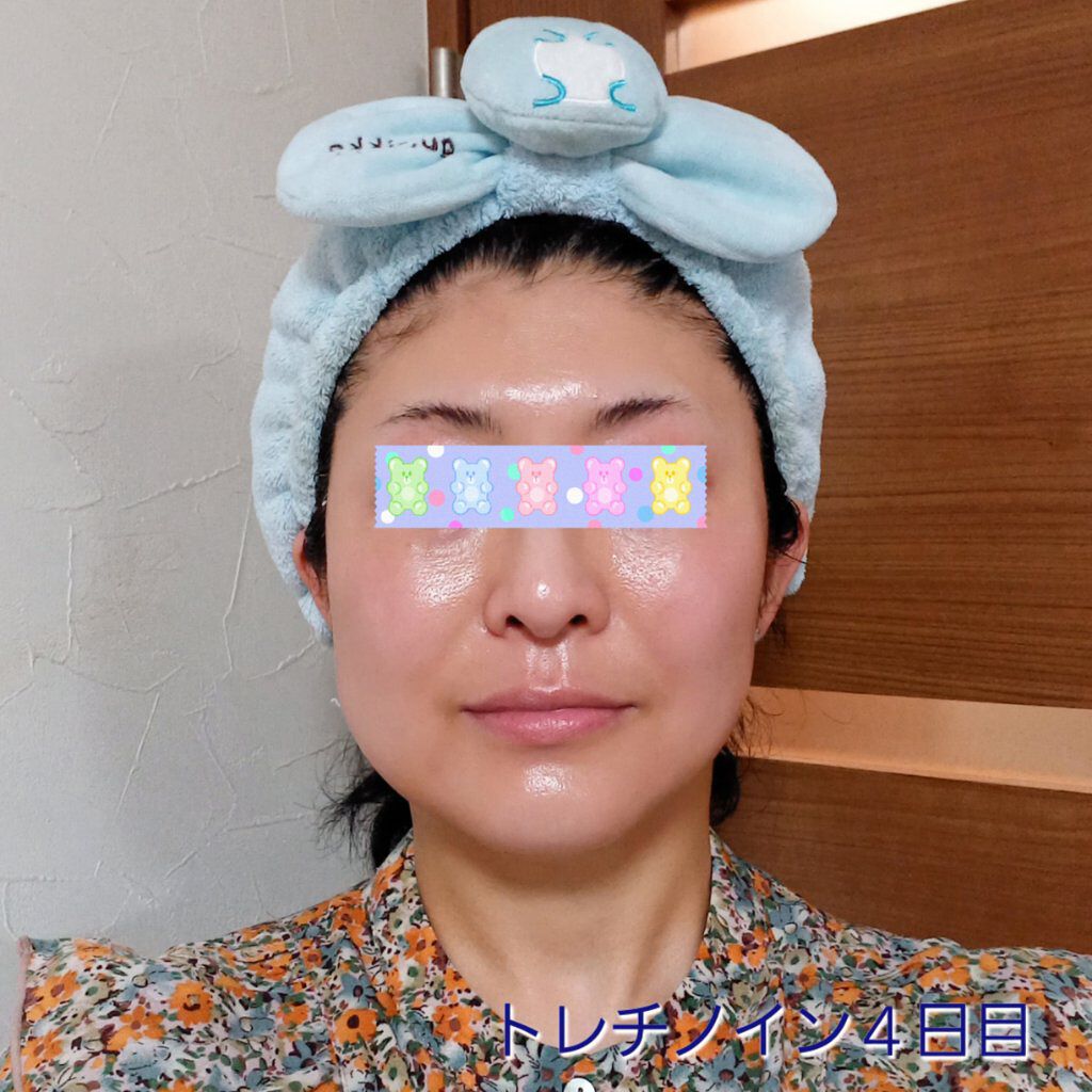 極潤α リフトクリーム/肌ラボ/フェイスクリームを使ったクチコミ（1枚目）