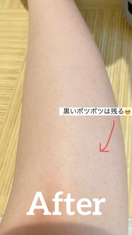 ミュゼコスメ メンズ 薬用ヘアリムーバルクリーム ホワイトシトラスの香り/ミュゼコスメ/除毛クリームを使ったクチコミ(7枚目)