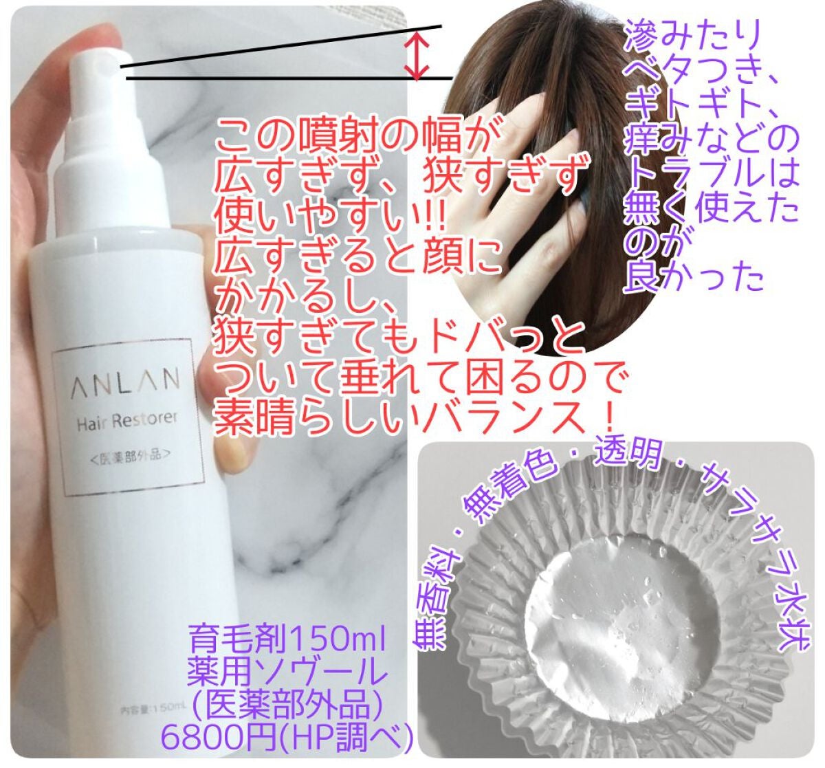 薬用ソヴール 育毛剤 /ANLAN/頭皮ローションを使ったクチコミ(1枚目)