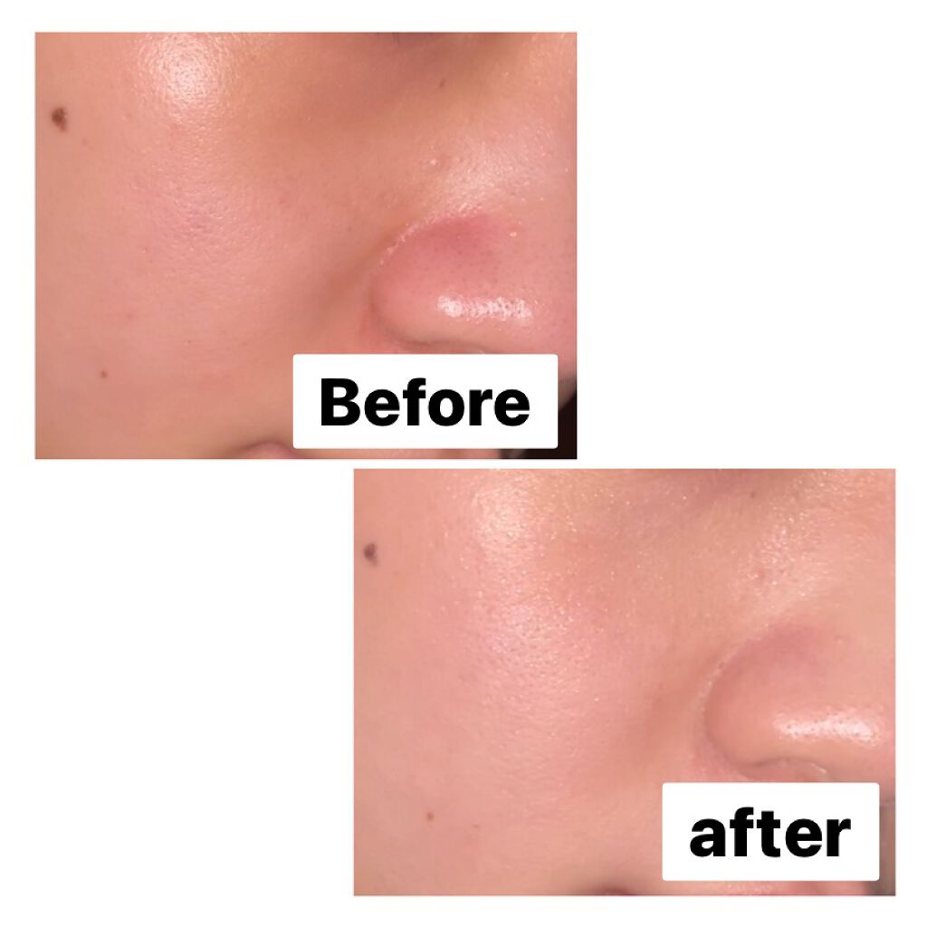 【旧】ディオールスキン フォーエヴァー フルイド グロウ/Dior/リキッドファンデーションを使ったクチコミ（2枚目）