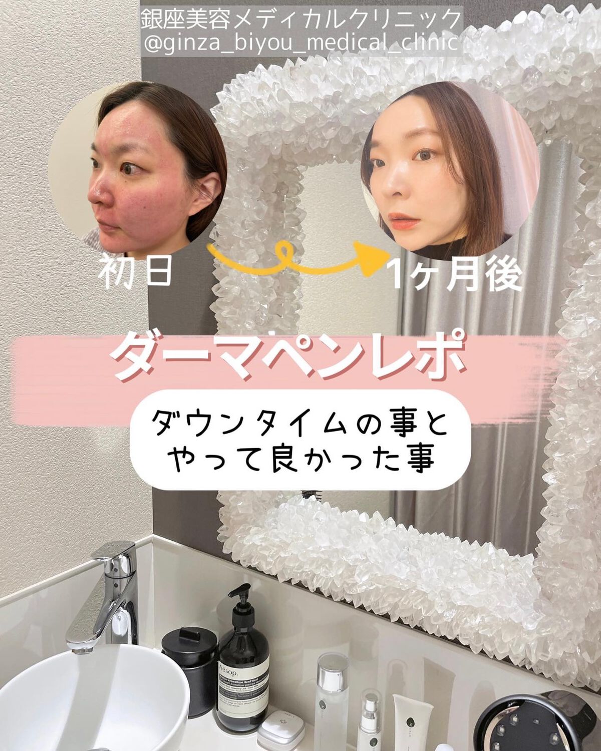 オリジナル ピュアスキンジェリー/ヴァセリン/ボディクリームを使ったクチコミ（1枚目）