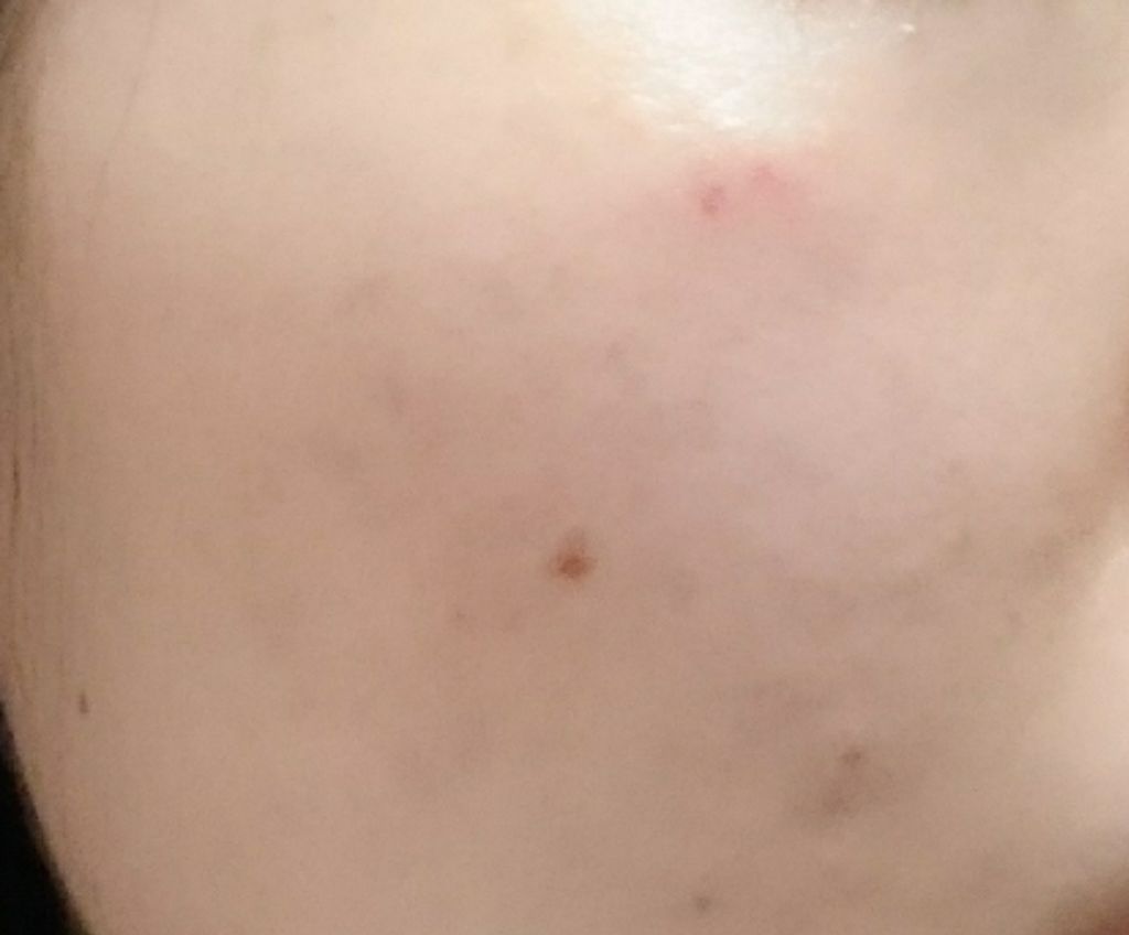 フォーエバー リブレイター エッセンス ローション/YVES SAINT LAURENT BEAUTE/化粧水を使ったクチコミ(3枚目)