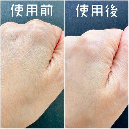 リンクルショット メディカル セラム N/リンクルショット/アイケア・アイクリームを使ったクチコミ(6枚目)