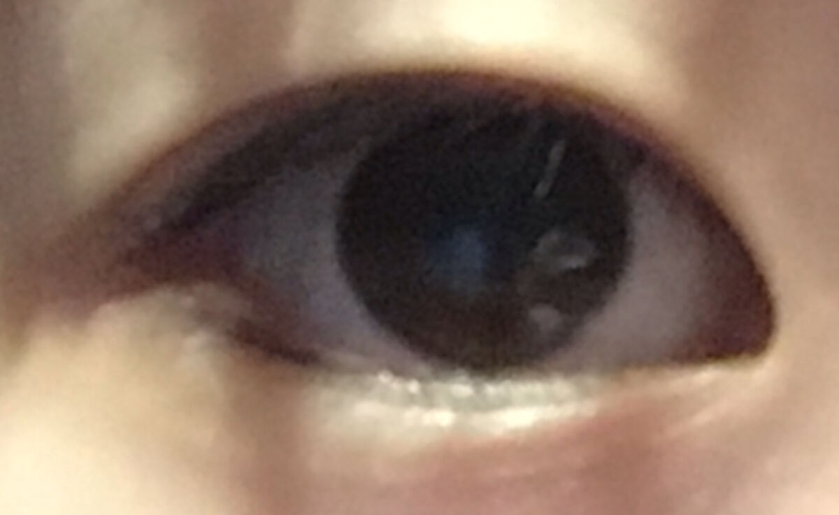 肌色タイプ/バンドエイド/その他を使ったクチコミ（2枚目）