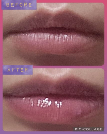 リッププランパーエクストラセラム/Borica/リッププランパーを使ったクチコミ(5枚目)