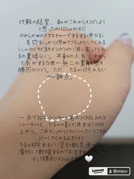 ディオールスキン フォーエヴァー スキン コレクト コンシーラー/Dior/リキッドコンシーラーを使ったクチコミ(4枚目)