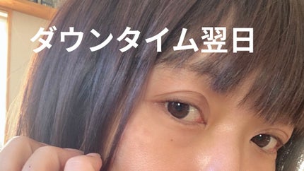 を使ったクチコミ(1枚目)