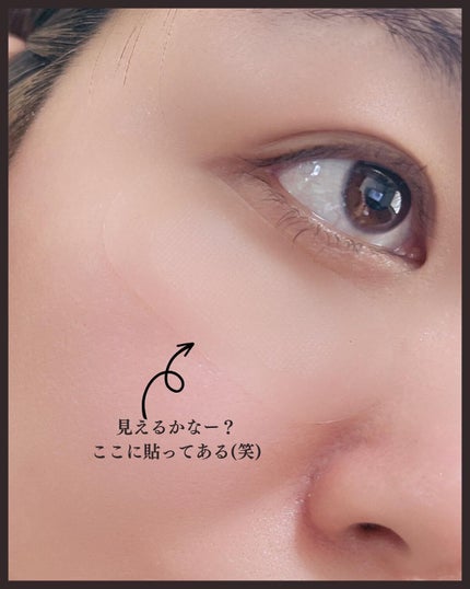 ゴールドコラーゲンニードルパッチ/SNP/アイケア・アイクリームを使ったクチコミ(4枚目)