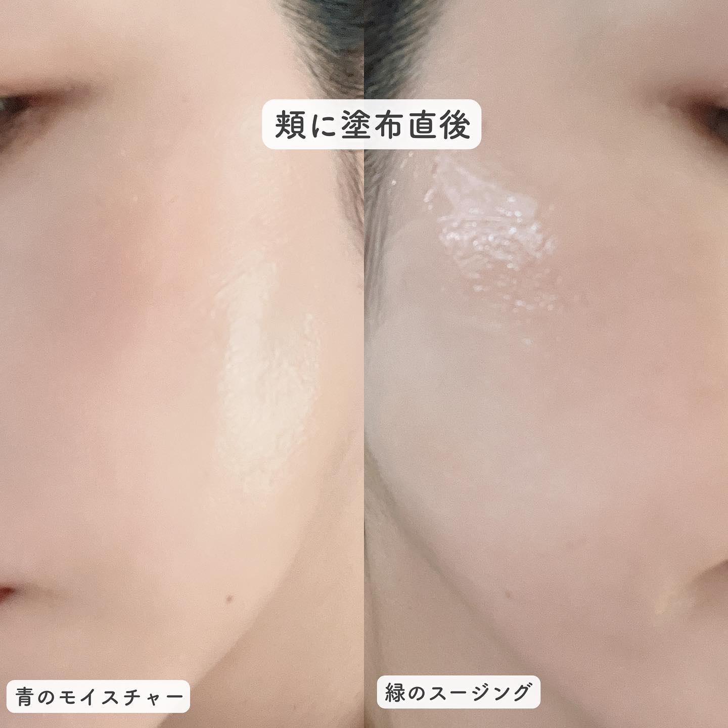 Dr.Gのフェイスクリームを徹底比較】レッドブレミッシュ クリアスー