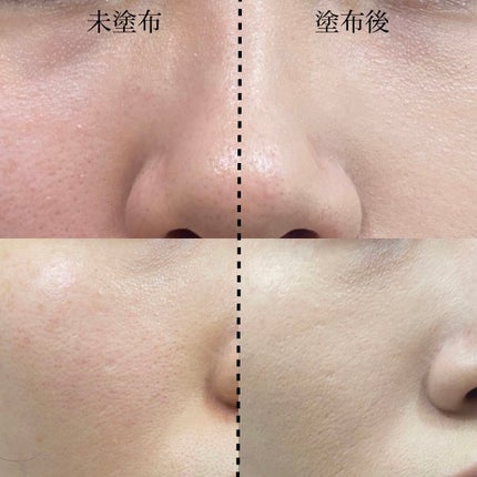 メゾンキツネ コラボ ネオクッション/LANEIGE/クッションファンデーションを使ったクチコミ(9枚目)