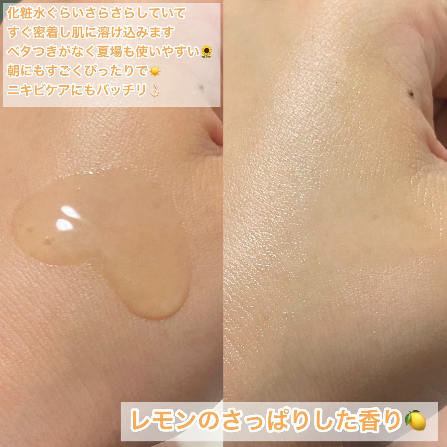 ビタペアC シミケアセラム/ネイチャーリパブリック/美容液を使ったクチコミ(4枚目)