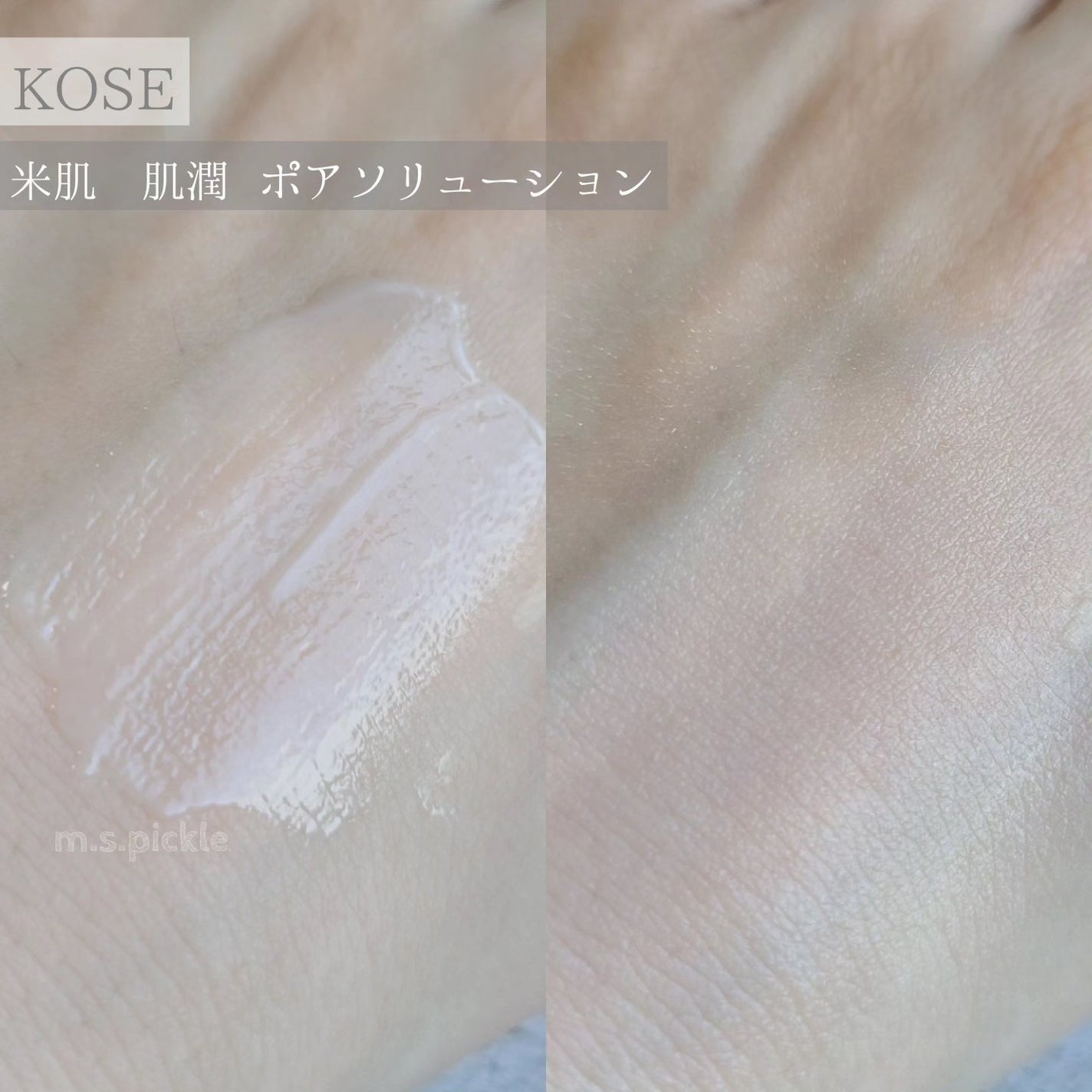 肌潤 ポアソリューション/米肌/美容液を使ったクチコミ(3枚目)