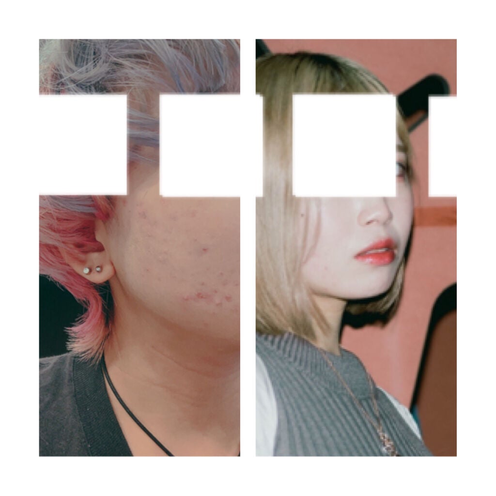 yanikasu on LIPS 「その③原因と改善その①をお読みでない方は冒頭だけで結構です。御..」(4枚目)