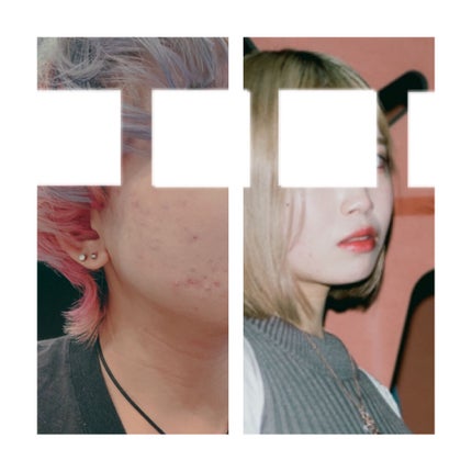 yanikasu on LIPS 「その③原因と改善その①をお読みでない方は冒頭だけで結構です。御..」(4枚目)