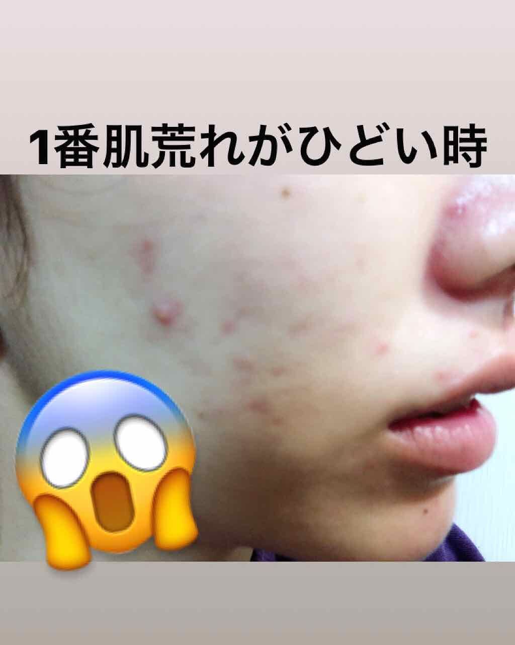 ワンステップオリジナルクリアパッド/COSRX/トナーパッドを使ったクチコミ（2枚目）