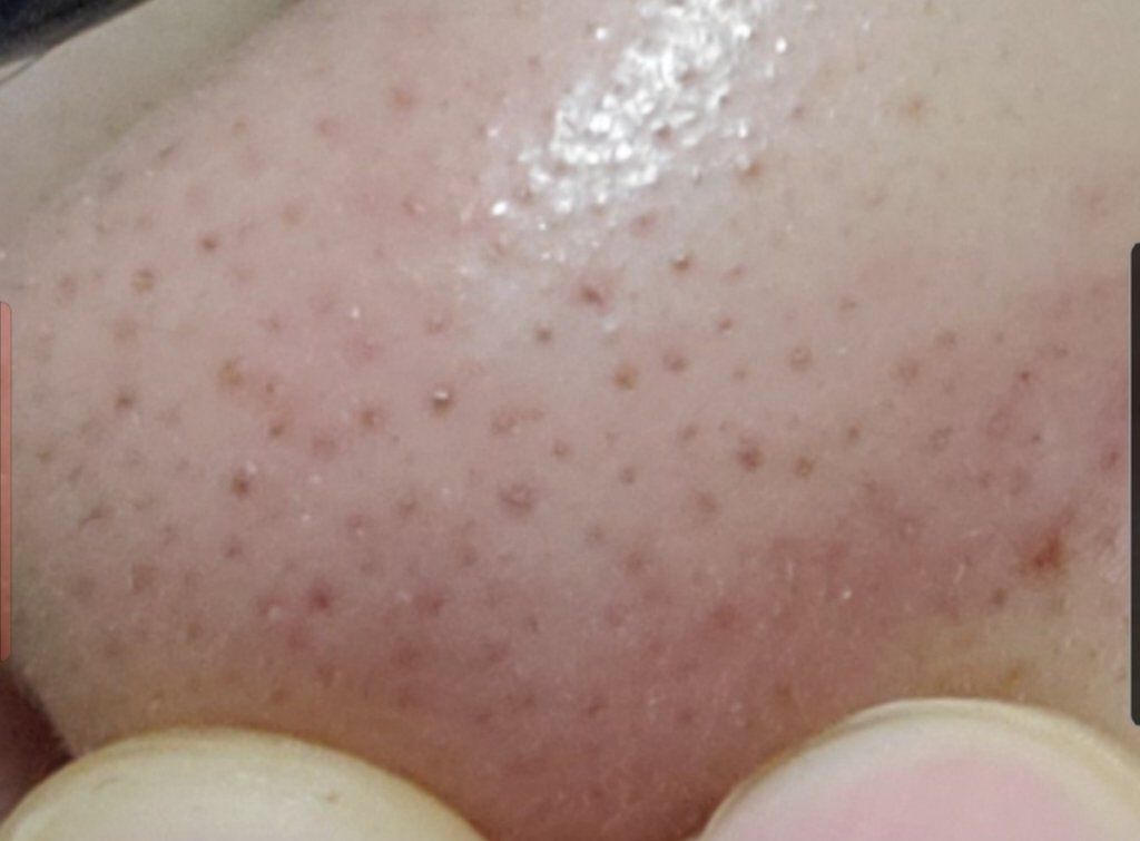 クリーンイットゼロ クレンジングバーム オリジナル/BANILA CO/クレンジングバームを使ったクチコミ（2枚目）