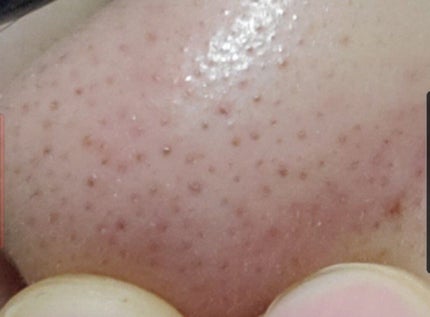 クリーンイットゼロ クレンジングバーム オリジナル/BANILA CO/クレンジングバームを使ったクチコミ(2枚目)