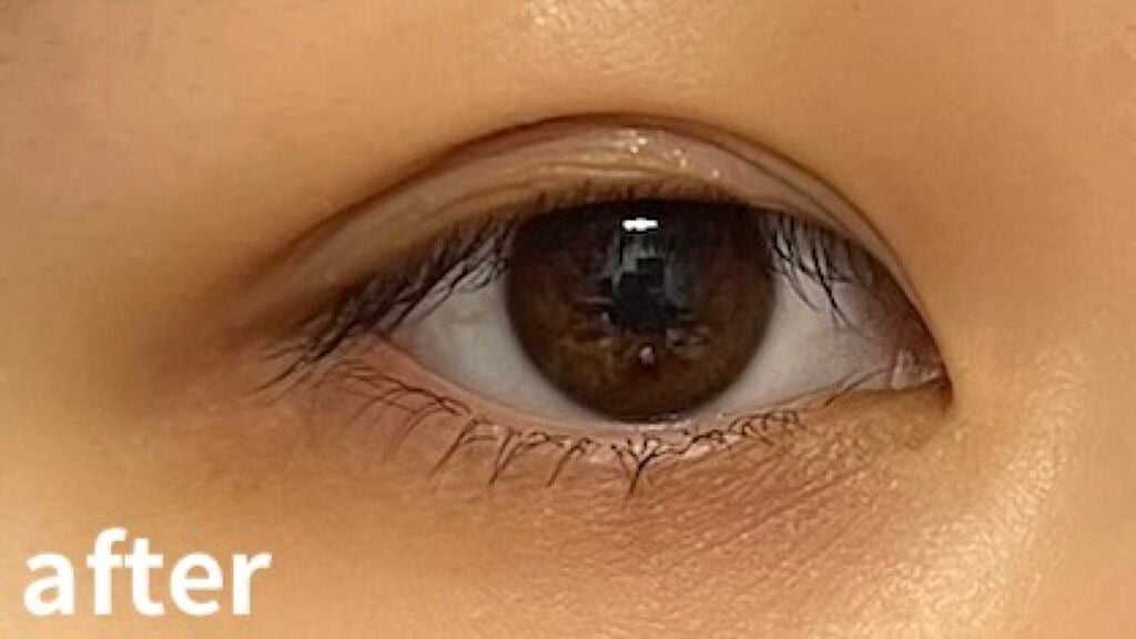 オリシキ アイリッドスキンフィルム /D-UP/二重まぶた用アイテムを使ったクチコミ(5枚目)