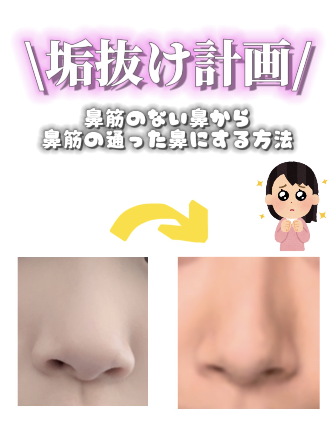 白潤 薬用美白化粧水/肌ラボ/化粧水を使ったクチコミ（1枚目）