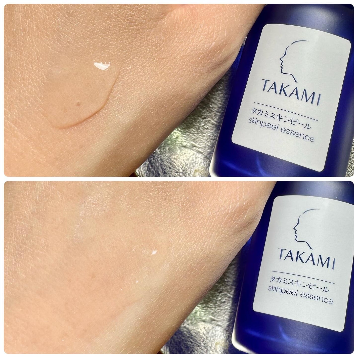 タカミスキンピール/タカミ/ブースター・導入液を使ったクチコミ(5枚目)