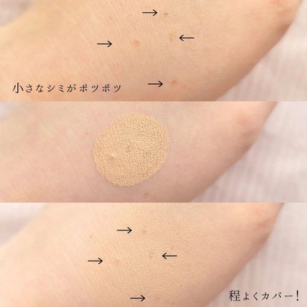 湘南美容コンシーラー/湘南美容/スティックコンシーラーを使ったクチコミ(6枚目)