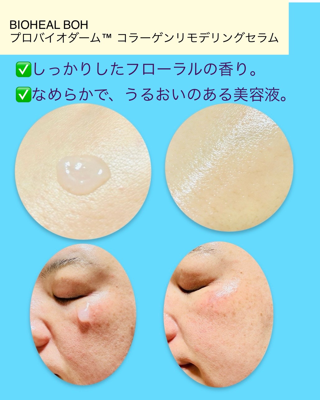 プロバイオダーム™ コラーゲンリモデリングセラム/BIOHEAL BOH/美容液を使ったクチコミ（2枚目）