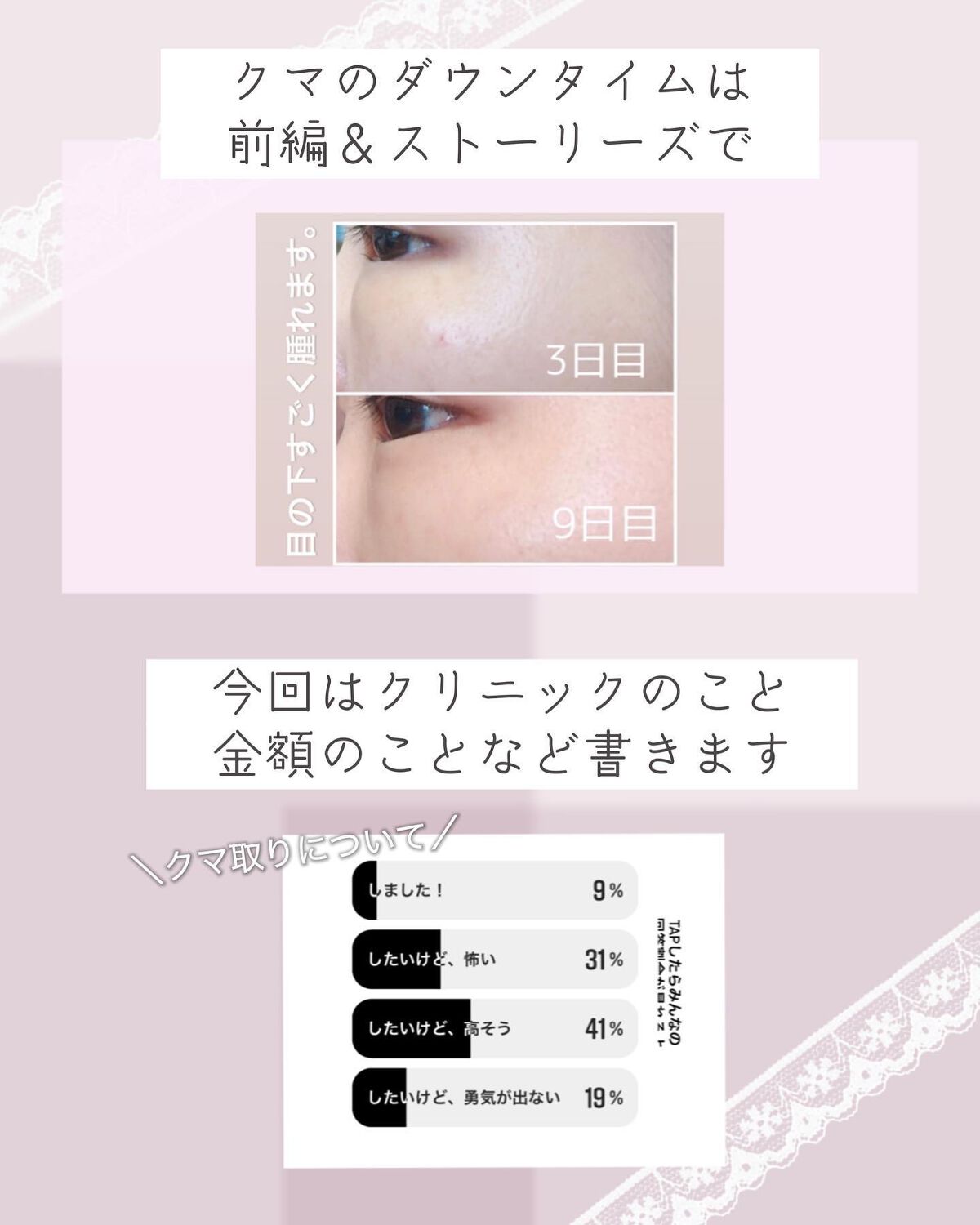 ぴーちゃん🧡インスタでコメント返信 on LIPS 「クマ取りレポ後編前編でダウンタイムの写真など載せています。スト..」(3枚目)