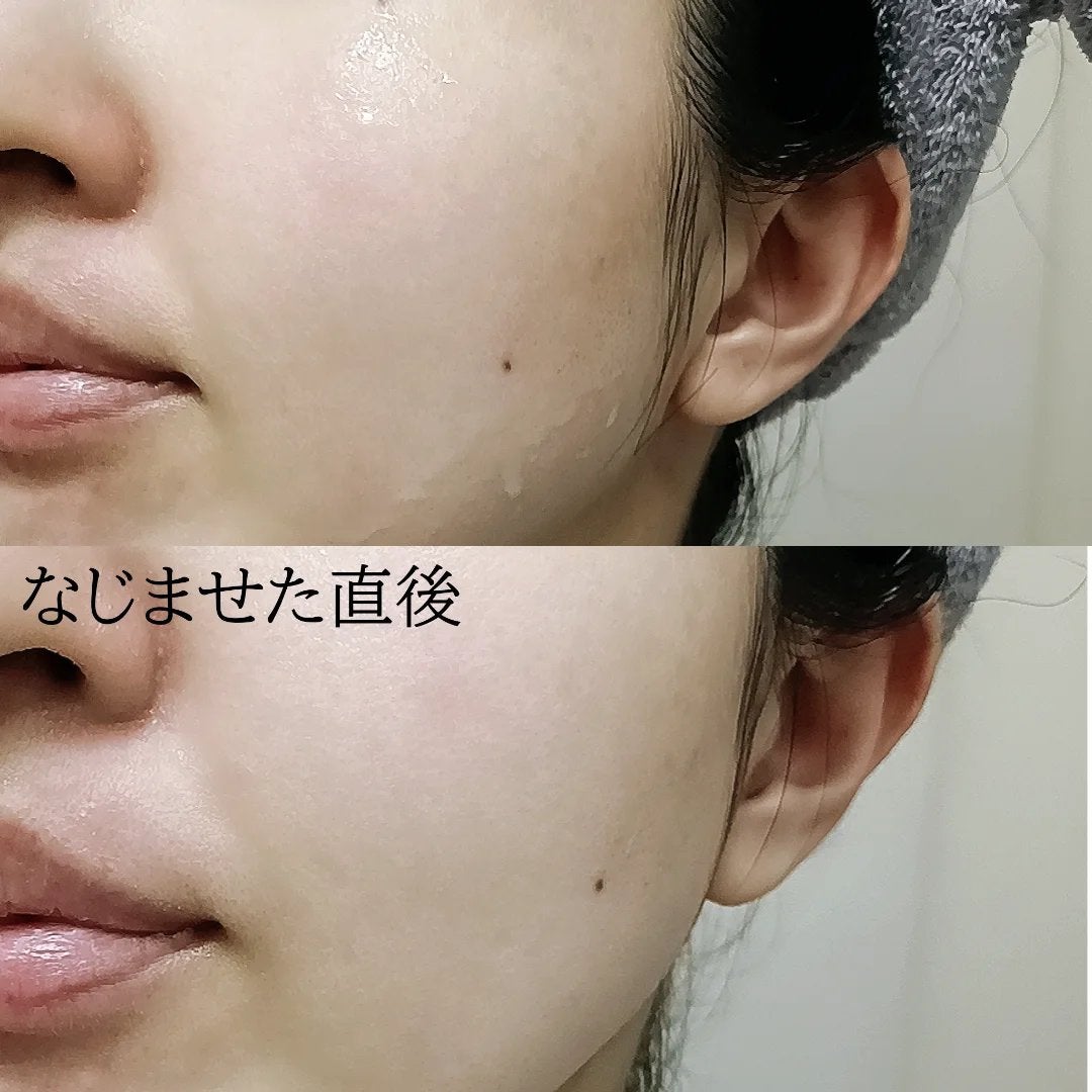 TXトーニングエッセンス2000/VT/美容液を使ったクチコミ(3枚目)