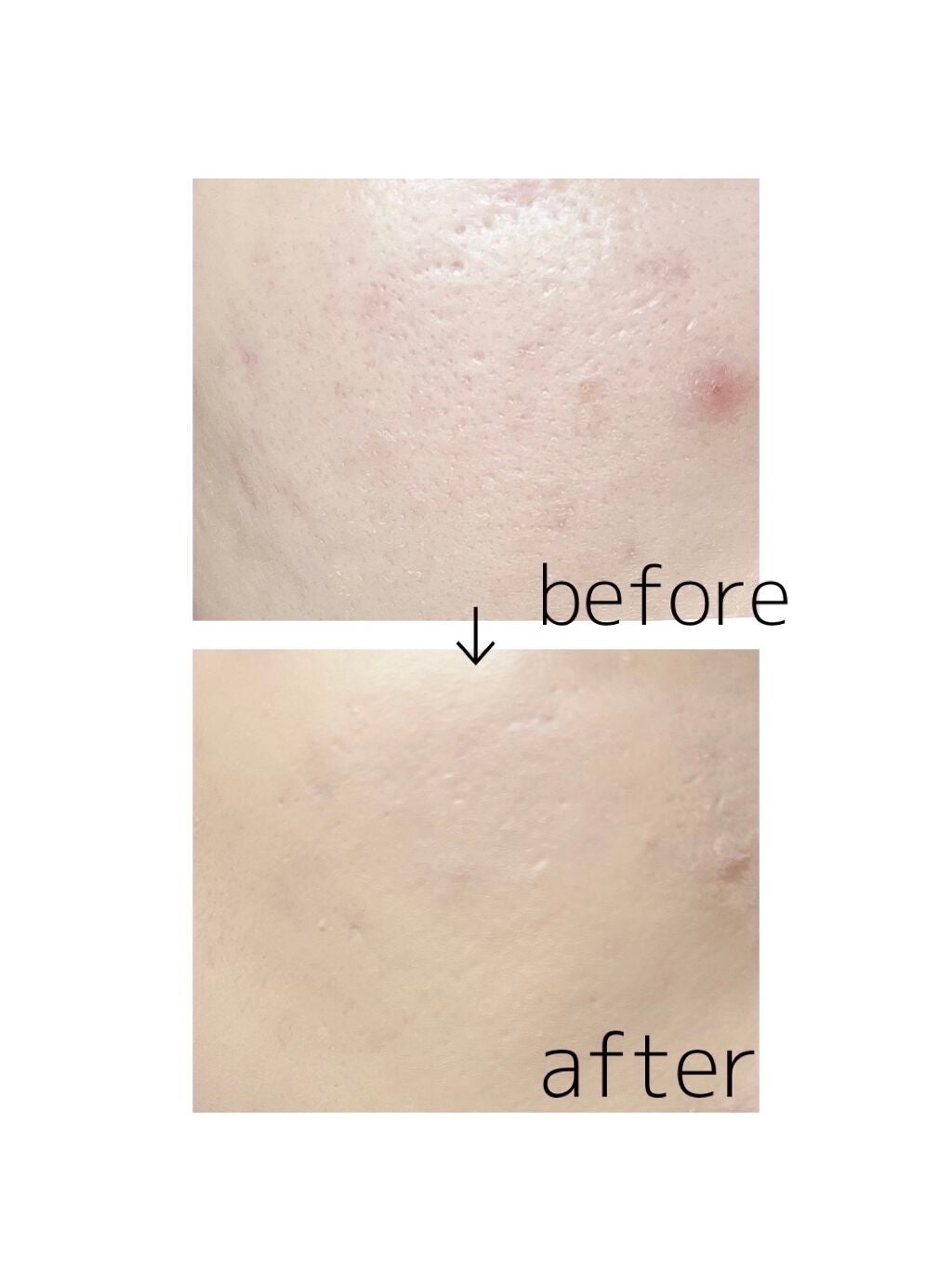 ディオールスキン フォーエヴァー フルイド グロウ/Dior/リキッドファンデーションを使ったクチコミ(2枚目)