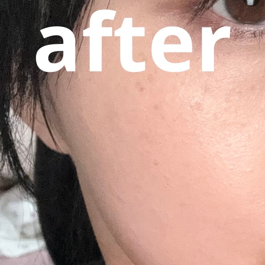 ディオールスキン フォーエヴァー スキン コレクト コンシーラー/Dior/リキッドコンシーラーを使ったクチコミ(3枚目)