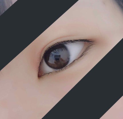 雫 on LIPS 「閲覧ありがとうございます🌟二重切開手術翌日の様子について紹介し..」(4枚目)