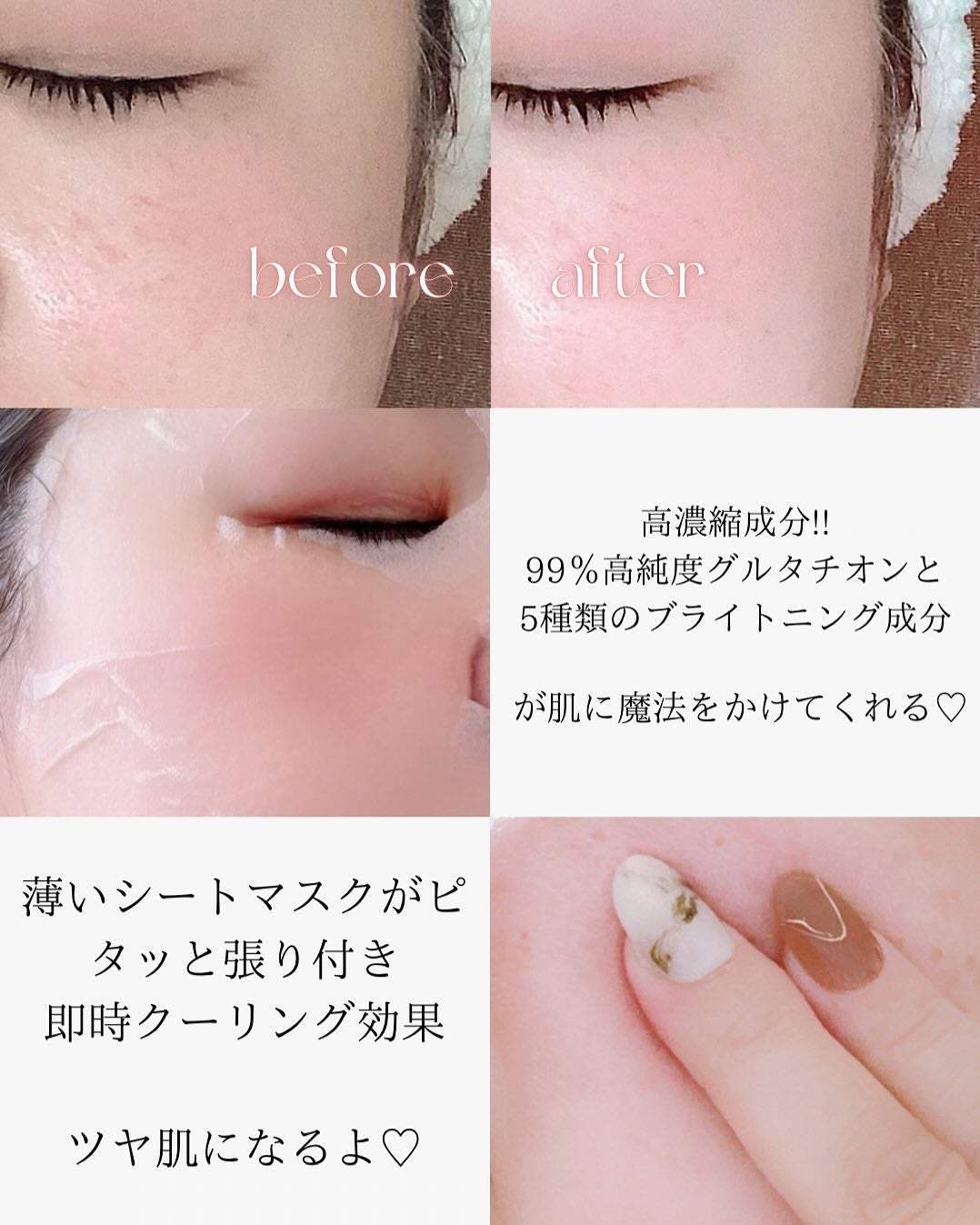 グルタシカ Mクリーム/Dr.Viuum/フェイスクリームを使ったクチコミ(3枚目)