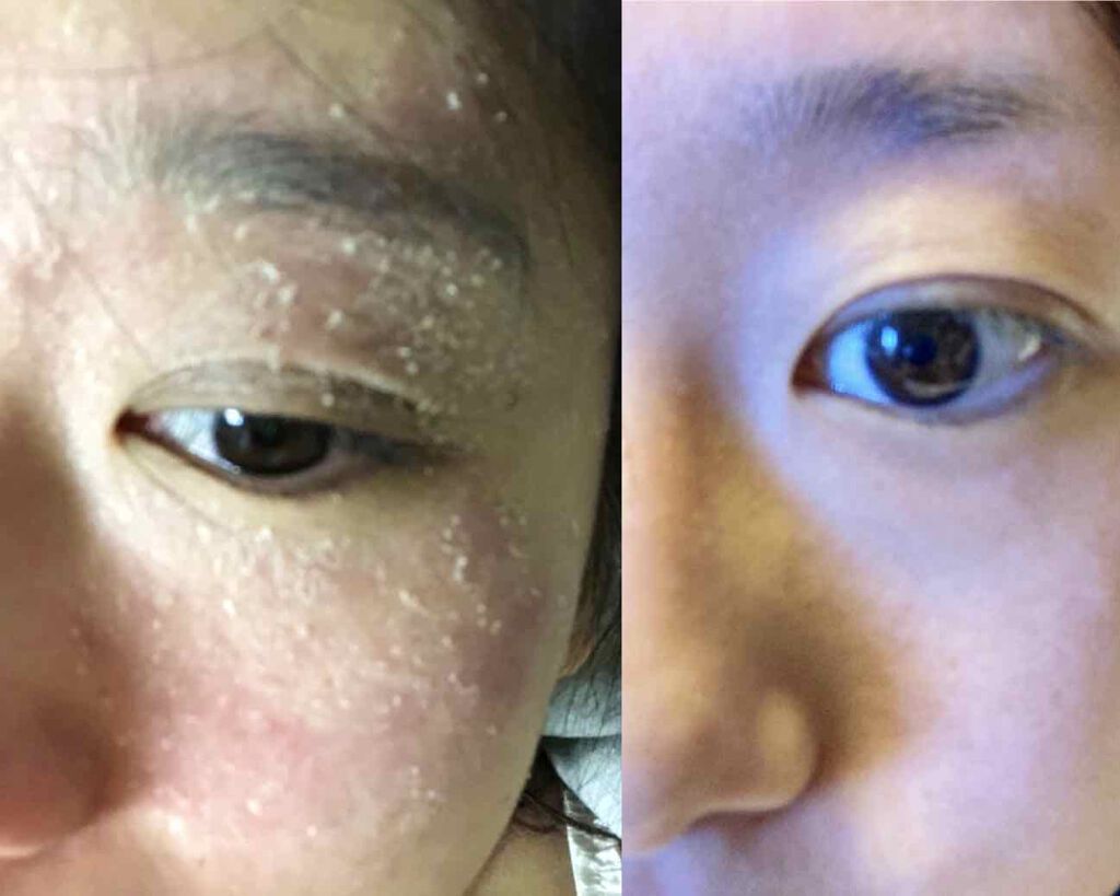 ミノン アミノモイスト モイストチャージ ミルク/ミノン/乳液を使ったクチコミ（1枚目）