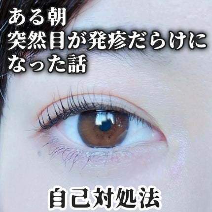 抗菌アイリスα(医薬品)/大正製薬/その他を使ったクチコミ(1枚目)